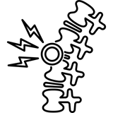 Spinal Stenosis